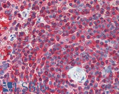 IHC-plus™ CAPZA1 / CAPZ Alpha 1 Antibody