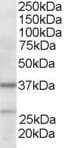 IHC-plus™ ARPC1B / p41-ARC / ARP2 Antibody (aa2-14)
