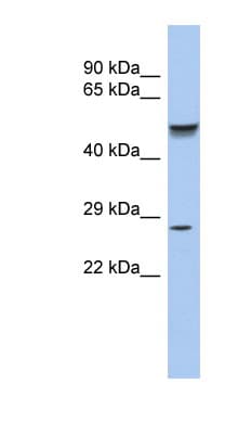PHOX2A Antibody (aa71-120)