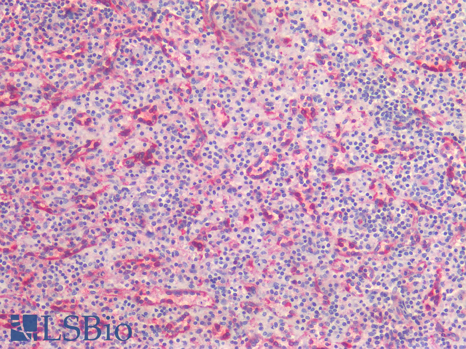PathPlus™ Polyclonal Rabbit anti-Human CAV1 / Caveolin 1 Antibody (N-Terminus, IHC)