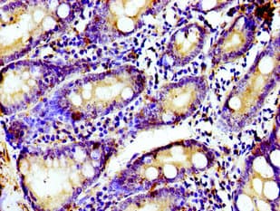 TUBGCP4 Antibody