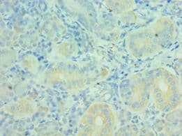 Polyclonal Rabbit anti-Human MTM1 / Myotubularin Antibody (aa484-603, IHC, WB)