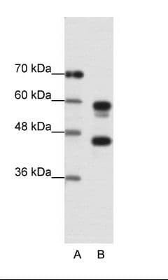 PSMC5 / SUG1 Antibody (C-Terminus)