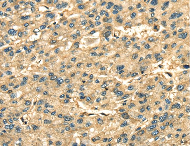 ANXA2 / Annexin A2 Antibody