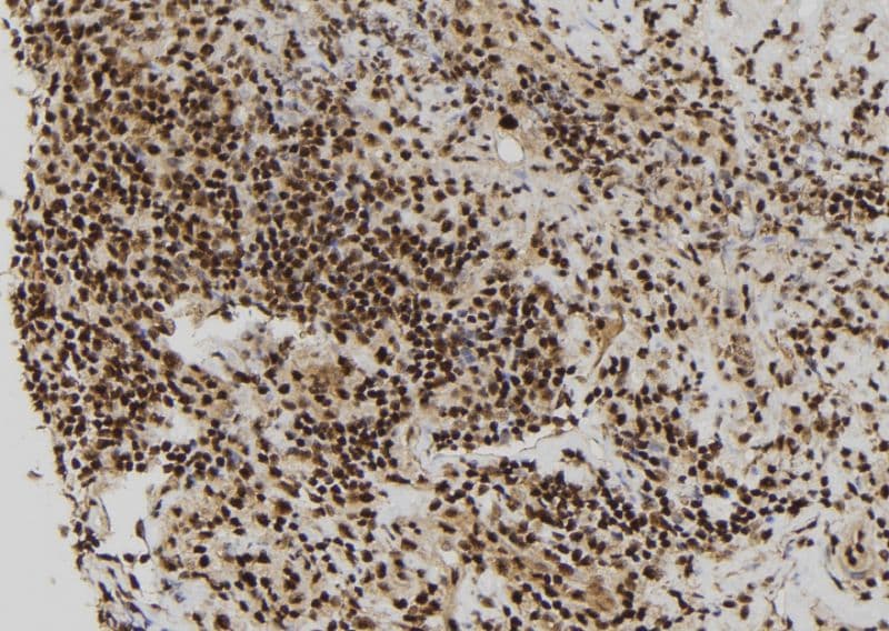 Polyclonal Rabbit anti-Human RBM15 Antibody (IHC, WB)