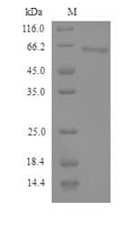 Human SEMG2 Protein (Recombinant 6His, N-terminus)