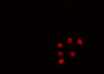RORA / ROR Alpha Antibody