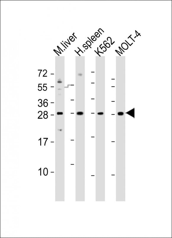SLA2 / SLAP2 Antibody (aa138-169)