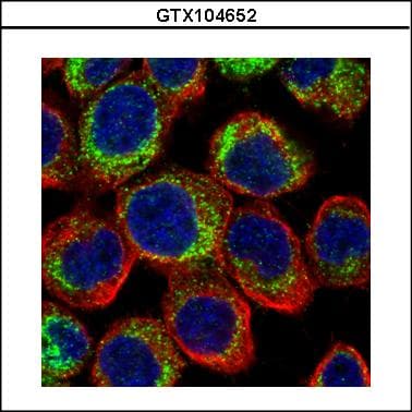 PDE4D Antibody (aa746-809)
