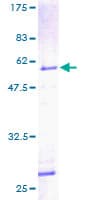 Human PHAP1 / ANP32A Protein (Recombinant GST)