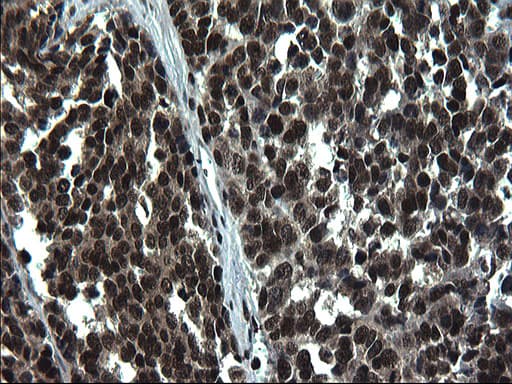 RPRD1B Antibody (clone OTI1C9)