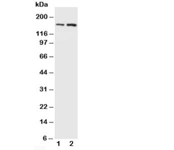 Polyclonal Rabbit anti-Human GRIN2B / NMDAR2B / NR2B Antibody (aa1131-1146, WB)