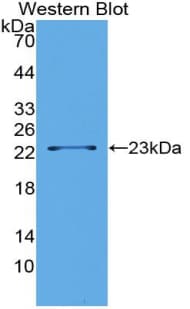 LSR / LISCH7 Antibody (aa335-589)