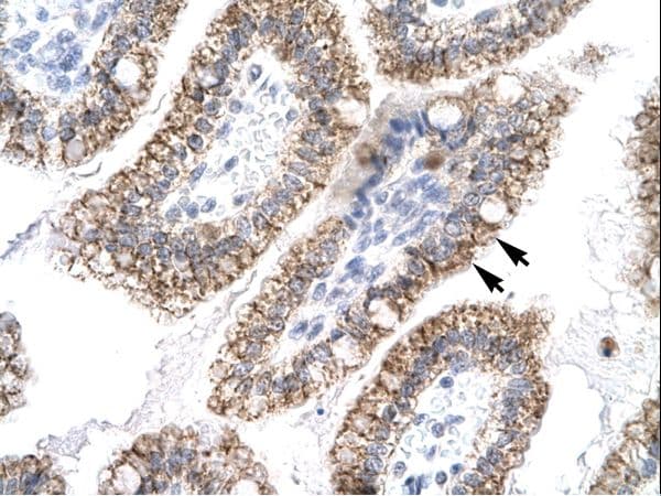 ACLP / AEBP1 Antibody (aa85-134)