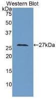 LOXL3 Antibody (aa509-712)