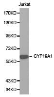 CYP19 / Aromatase Antibody