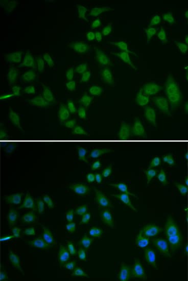 Polyclonal Rabbit anti-Human TP63 / p63 Antibody (IHC, IF, WB)