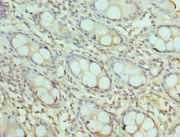 AKTIP / FTS Antibody (aa1-292)