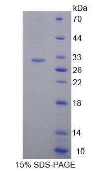 Human CDC7 Protein (Recombinant His-T7, N-terminus)