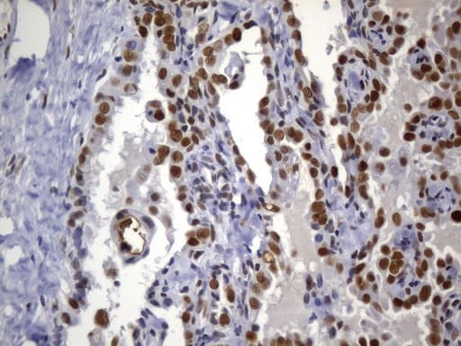 Monoclonal Mouse anti-Human MSH2 Antibody (clone UMAB259, Carrier-free, aa1-304, IHC)