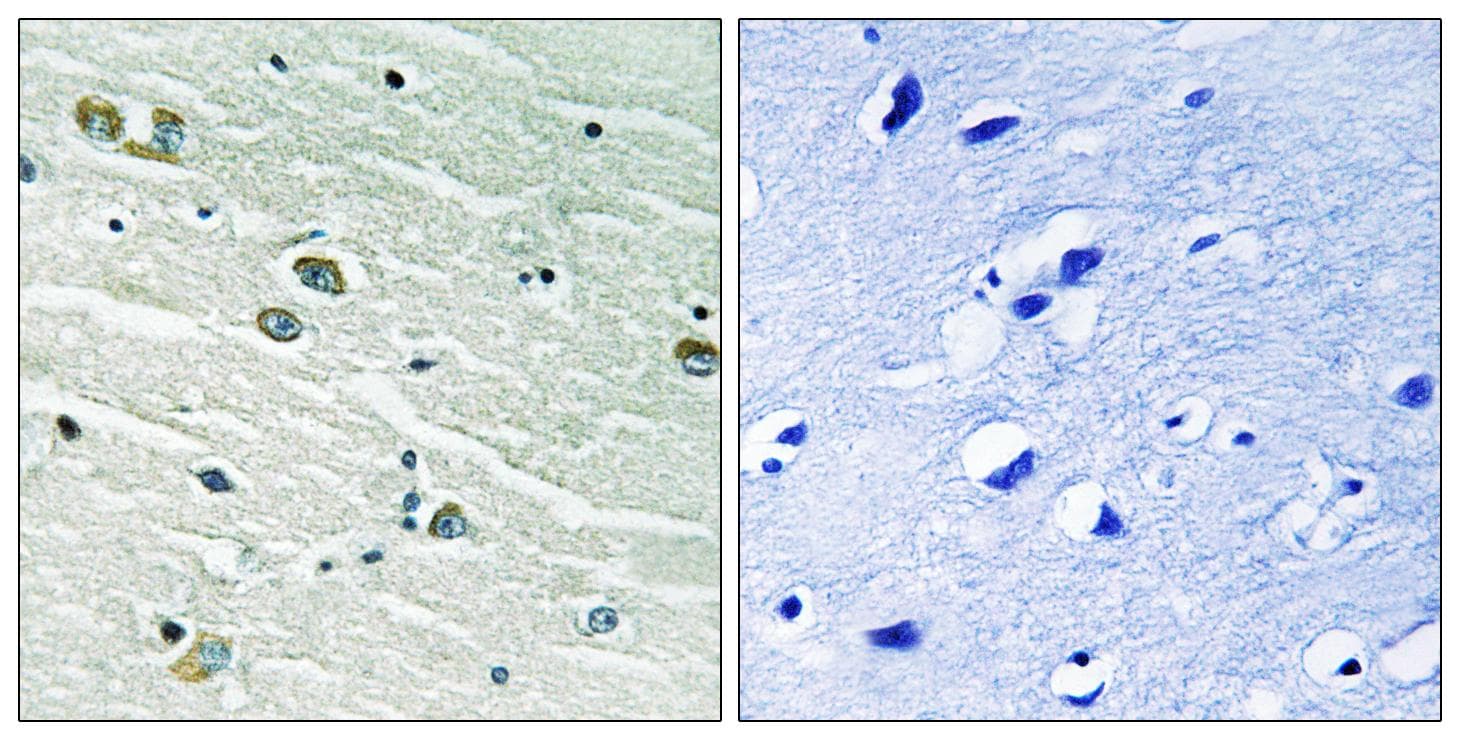 Polyclonal Rabbit anti-Human MER / MERTK Antibody (p749/681, IHC, WB)