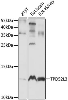 TPD52L3 Antibody