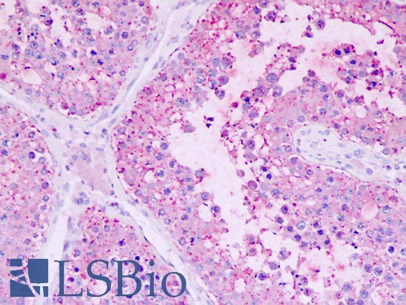 IHC-plus™ GPR22 Antibody (C-Terminus)
