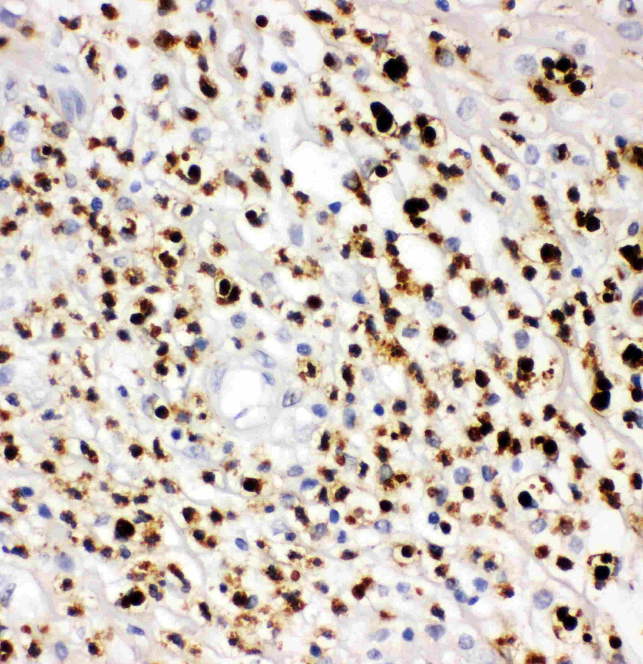 Polyclonal Rabbit anti-Human MPO / Myeloperoxidase Antibody (IHC, WB)