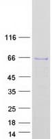 Human EDC3 Protein (Recombinant Myc-DDK (Flag))