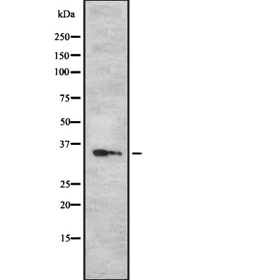 SGCB / SGC / Sarcoglycan Beta Antibody