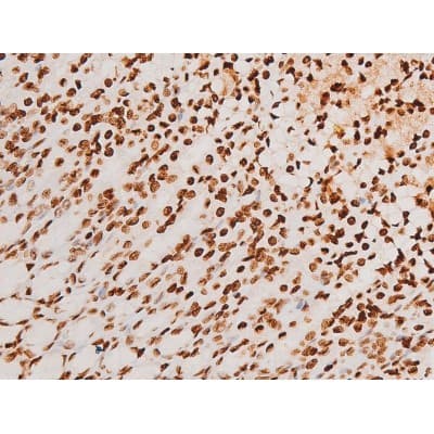 Polyclonal Rabbit anti-Human SYK Antibody (phospho-Tyr348, IHC, IF, WB)