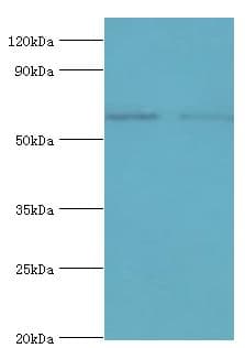 Polyclonal Rabbit anti-Human SOAT1 Antibody (aa1-130, IHC, WB)