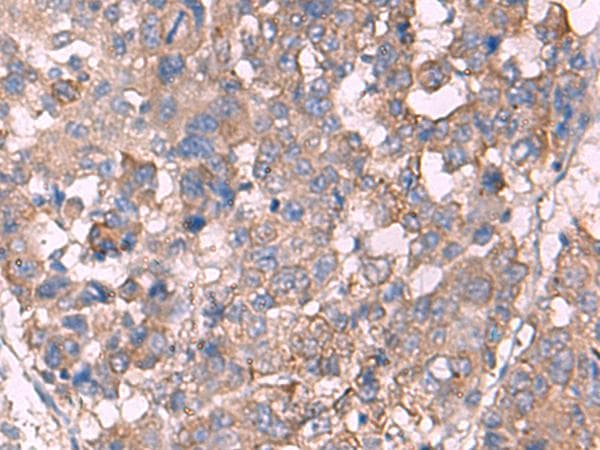 Polyclonal Rabbit anti-Human KCNN3 / SK3 Antibody (IHC)