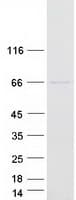 Human FUT8 Protein (Recombinant Myc-DDK (Flag))