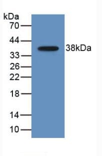 CCL22 / MDC Antibody