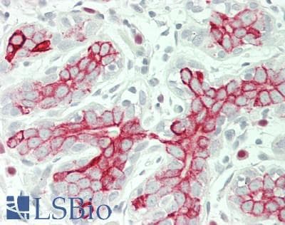 IHC-plus™ PTTG1IP / PBF Antibody (Internal)