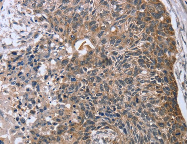 RASSF7 Antibody