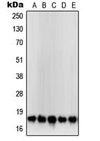 SOD1 / Cu-Zn SOD Antibody (Internal)