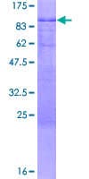 Human ZNF513 Protein (Recombinant GST)