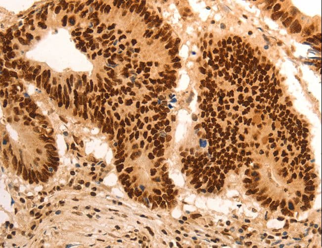 Polyclonal Rabbit anti-Human E2F7 Antibody (IHC)