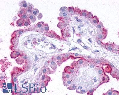 PathPlus™ Polyclonal Rabbit anti-Human CRHR2 / CRF2 Receptor Antibody (Extracellular Domain, IHC)