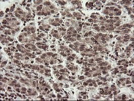 CHN1 Antibody (clone OTI2G6)
