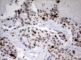 TOP2A / Topoisomerase II Alpha Antibody (aa1100-1531, clone OTI2A9)