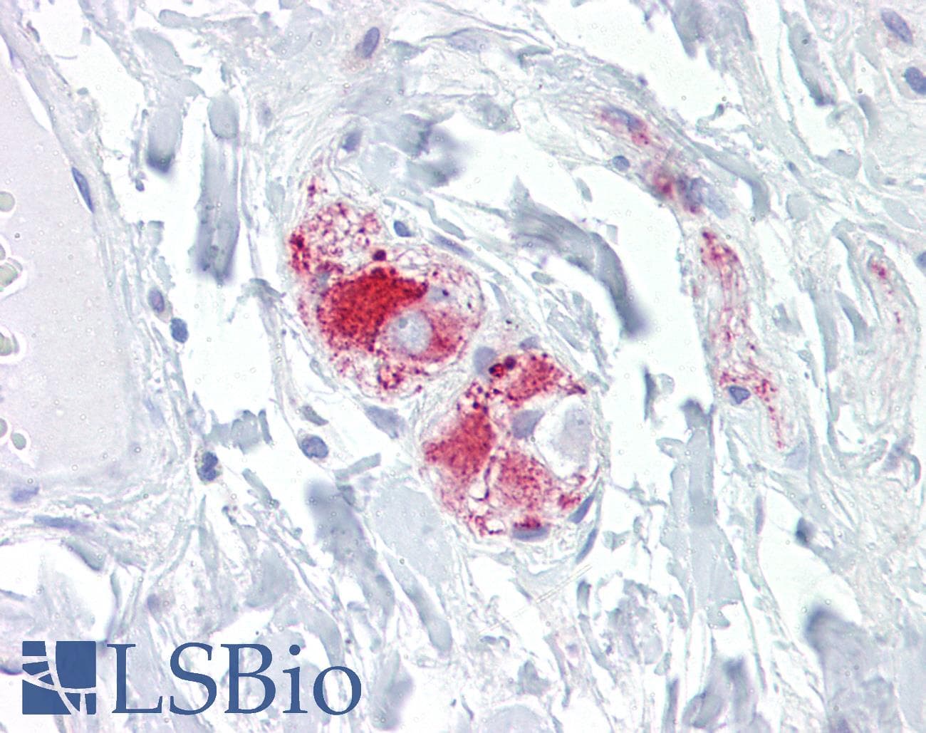 IHC-plus™ DISPA / DISP1 Antibody