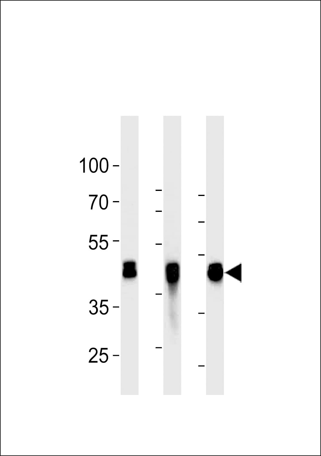 KRT18 / CK18 / Cytokeratin 18 Antibody (clone 695CT17.2.6)