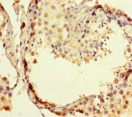 RTEL1 Antibody
