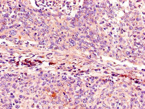 p16INK4a / CDKN2A Antibody