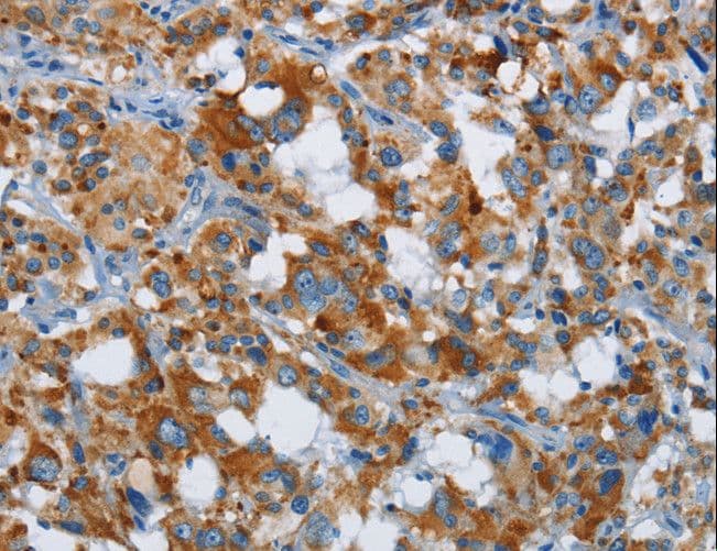 ETHE1 Antibody