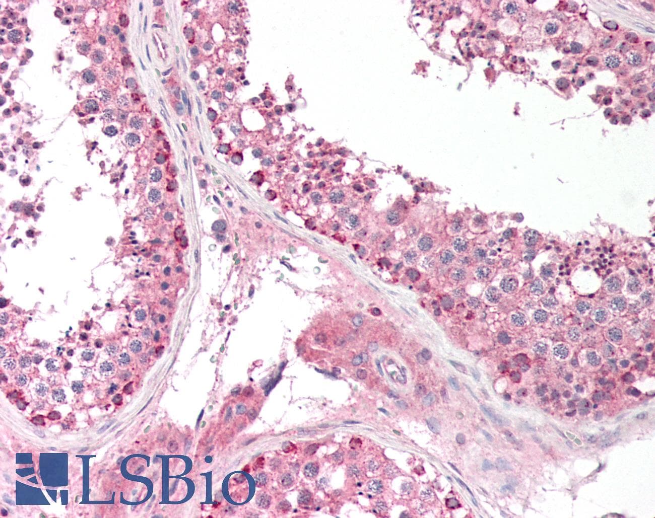 BAD Antibody