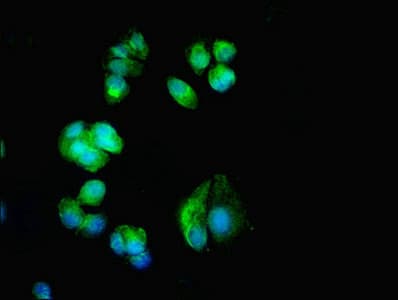 Polyclonal Rabbit anti-Human CACNA1H / Cav3.2 Antibody (IHC, IF)